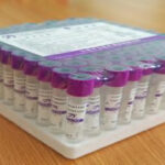edta-vacutainer-purple-top