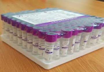 edta-vacutainer-purple-top