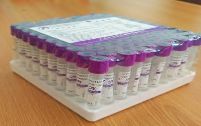 edta-vacutainer-purple-top